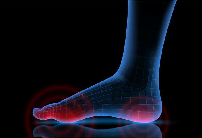 5 Ways to Treat the Pain from Plantar Fasciitis